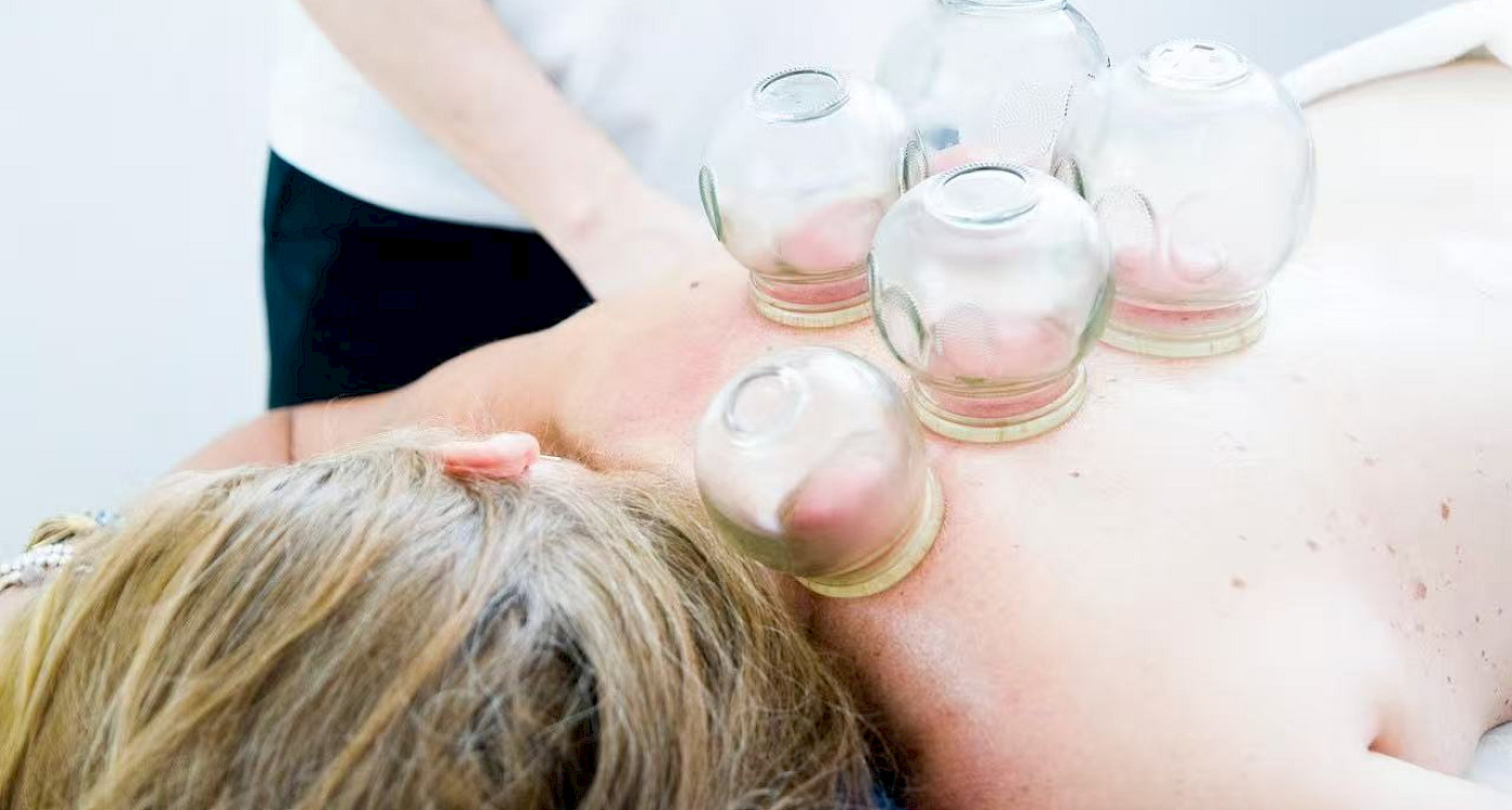 Cupping in action